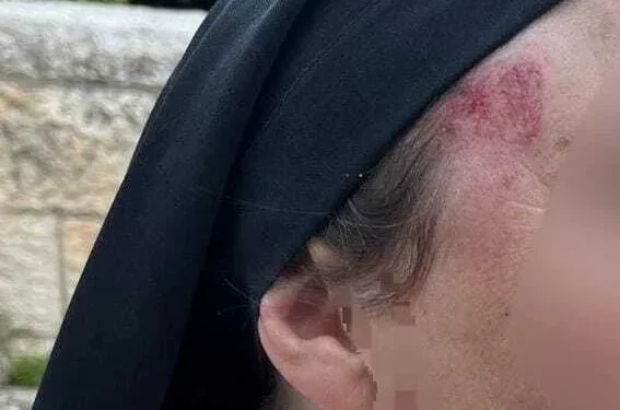 Detienen a hombre por agredir a monja cerca de la Tumba del Rey David