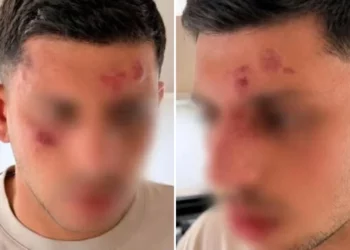 Israelí fue atacado en Golders Green tras ser oído hablar hebreo