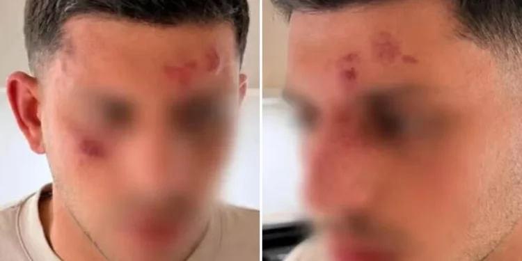 Israelí fue atacado en Golders Green tras ser oído hablar hebreo