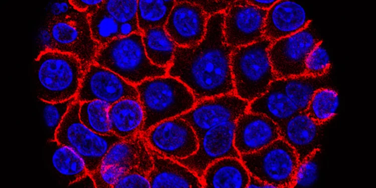 Pastilla experimental duplica la supervivencia en cáncer de páncreas avanzado