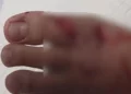 The injuries