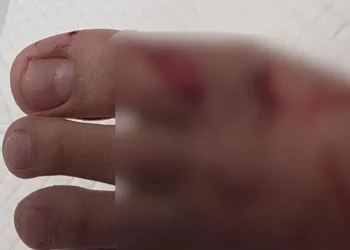 The injuries
