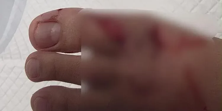 The injuries