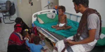 Mohammed al-Salami, desplazado con su familia desde Mokha, junto a su hijo Tarek, de 7 años, que presenta síntomas de desnutrición y recibe tratamiento en Buraiqa, Yemen, el 22 de septiembre de 2026.