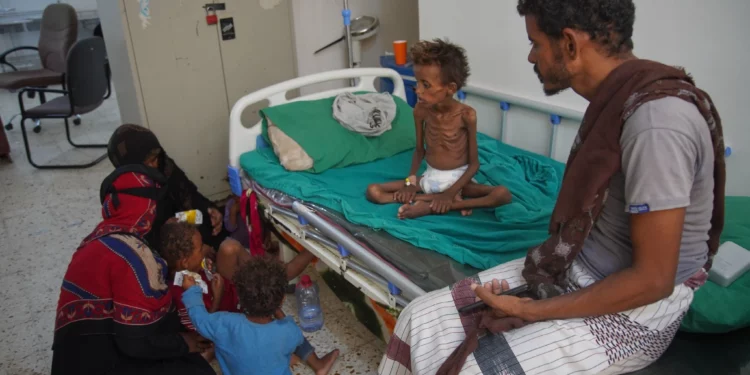 Mohammed al-Salami, desplazado con su familia desde Mokha, junto a su hijo Tarek, de 7 años, que presenta síntomas de desnutrición y recibe tratamiento en Buraiqa, Yemen, el 22 de septiembre de 2026.