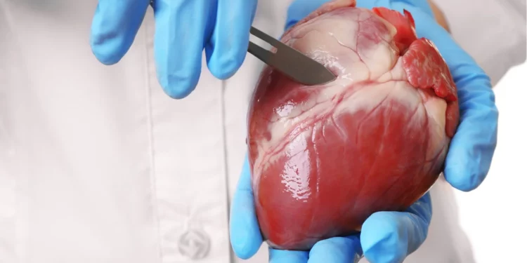 Granadas, fruta asociada con la producción de urolitina A