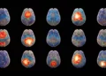 La startup israelí Hemispheric desarrolla un modelo de IA para descifrar el lenguaje del cerebro