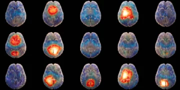 La startup israelí Hemispheric desarrolla un modelo de IA para descifrar el lenguaje del cerebro